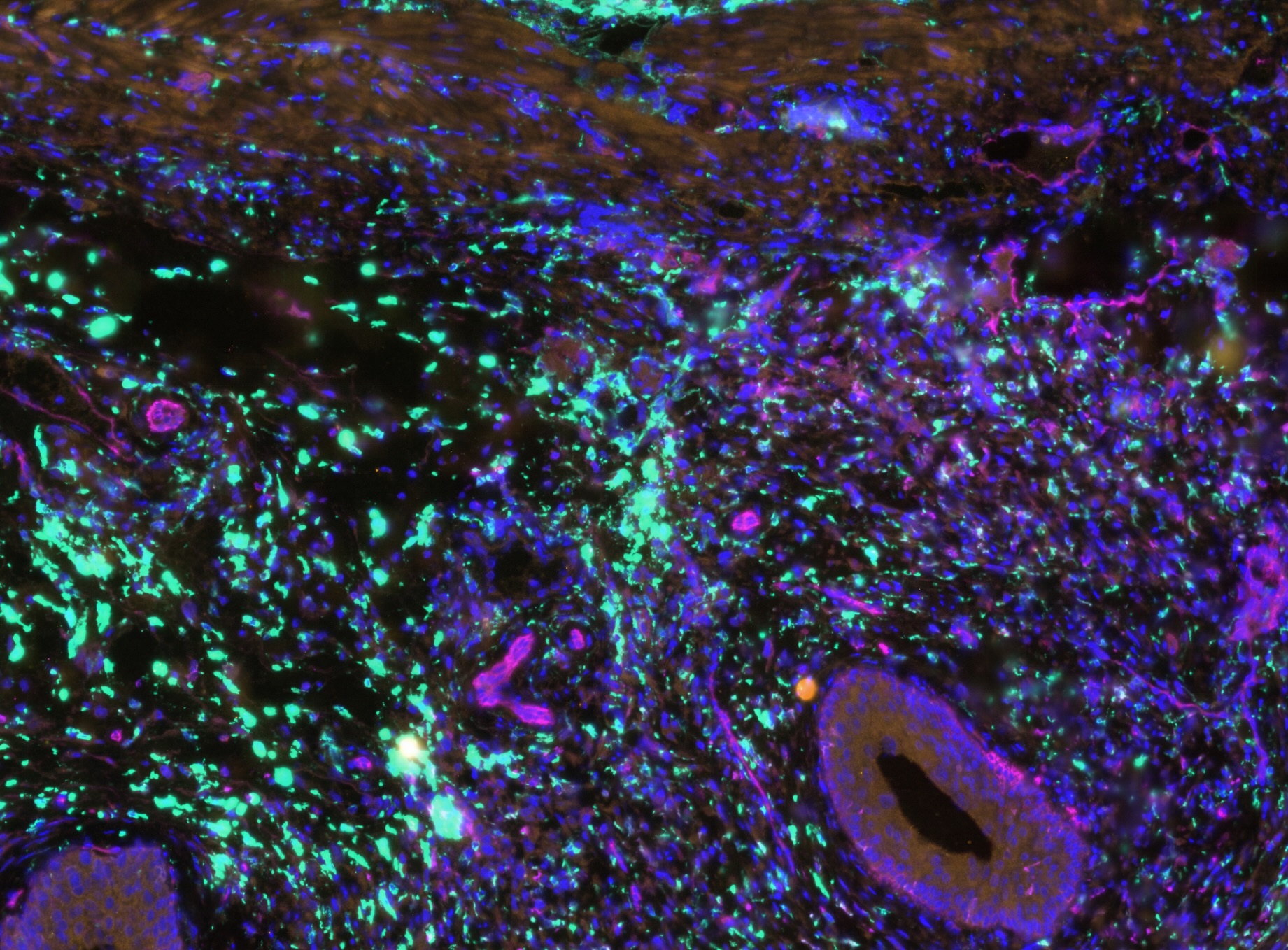 Spatial biology, imaging, and radiogenomics